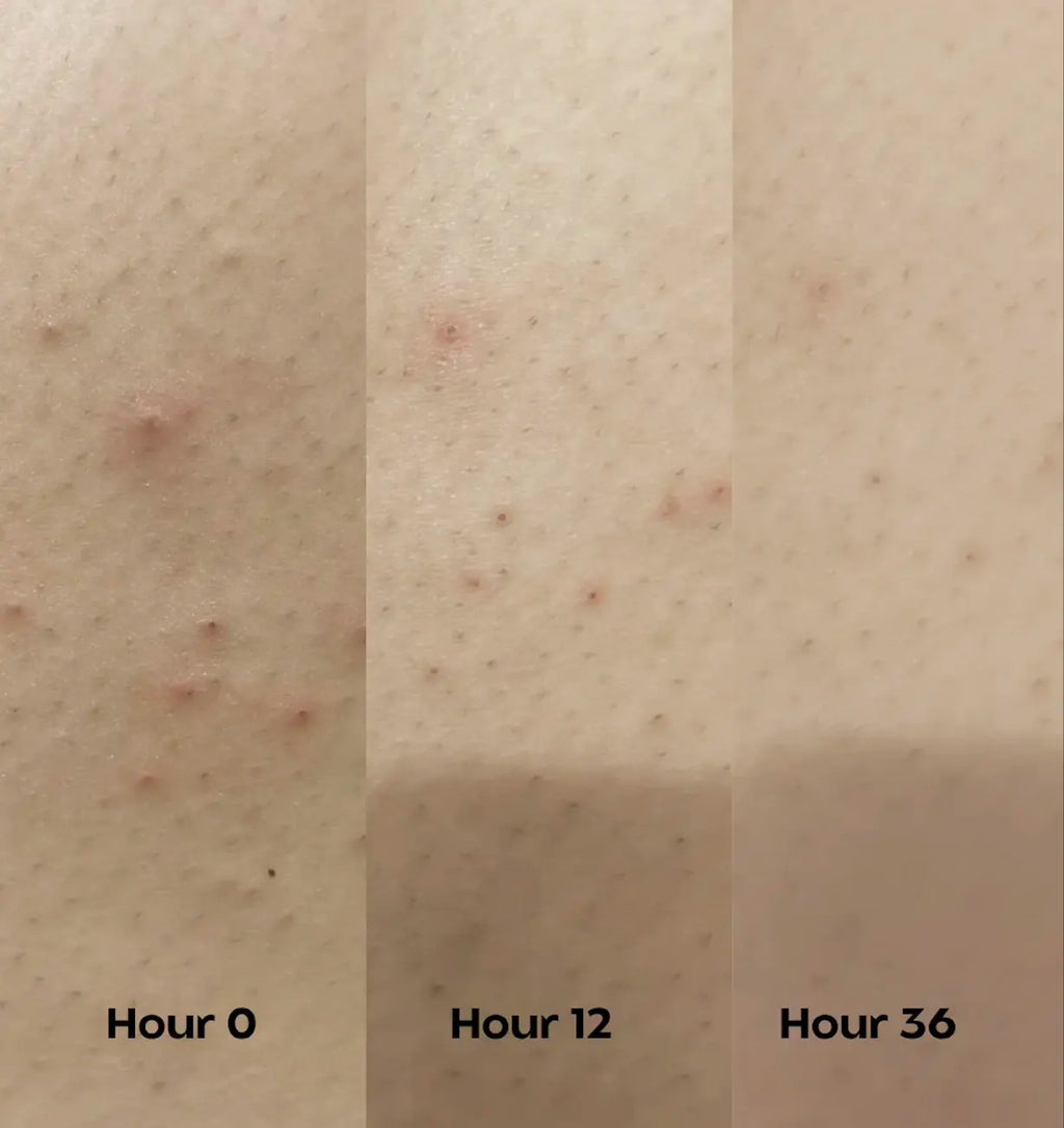 Bumps Off - Exfoliating Body Stick (30g)