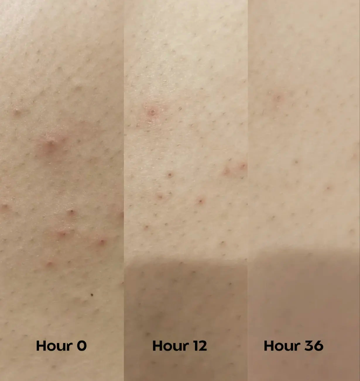 Bumps Off - Exfoliating Body Stick (30g)